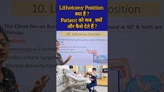 Lithotomy Position क्या है  Patient को कब क्यों और कैसे देते हैं reels medicalstudent shorts [upl. by Devlin]