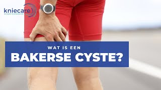 Wat is een Bakerse cyste  Uitleg over het ontstaan en behandeling [upl. by Euginimod]