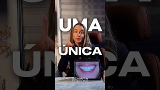 diastema RenataFreitas odontologia [upl. by Ynnob]