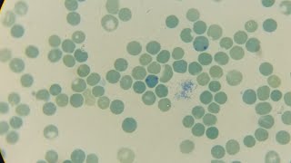 paramedic physiology hematology reticulocyte staining method [upl. by Ycak400]