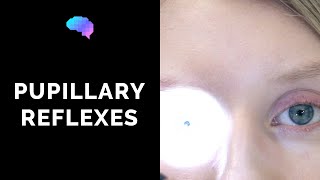 Pupillary Reflexes  OSCE Guide Clip  UKMLA  CPSA [upl. by Melli]