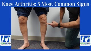 Knee Arthritis 5 Most Common Signs You Have It [upl. by Esiled807]