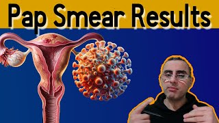 Pap Smear 101  Explained Pap Smear results meaning Pap Test [upl. by Christa540]