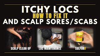 How to Fix Itchy Locs and Scalp SoresScabs [upl. by Eiznekam446]