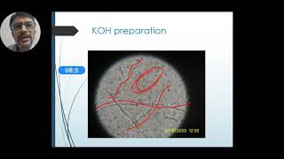 Laboratory diagnosis of dermatophytes [upl. by Vi635]