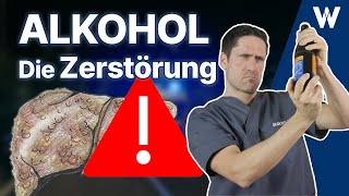 Die Zerstörung Die gefährlichste Droge der Welt  Folgen von Alkohol für Deinen Körper [upl. by Erika700]