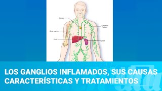 Los ganglios inflamados sus causas características y tratamientos [upl. by Derna]