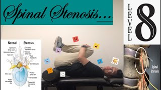 Major Exercises of Lumbar Spinal StenosisBack PainWeakness of legNumbnessTingling  Level 8 [upl. by Gerry]