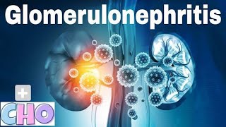 Glomerulonephritis  Kidney  Notes [upl. by Nohcim708]