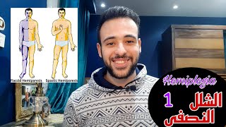 Hemiplegia and Stroke  الشلل النصفى وعلاقتها بالسكته الدماغيه  Eslam wael keshta [upl. by Dlorah]