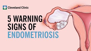 5 Warning Signs of Endometriosis [upl. by Etnuahs796]