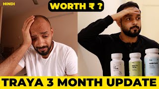 ✅ Traya Hair Regrowth👩‍🦲3 Month Progress Update 👉 My Honest Opinion 🟡 from hair loss to Thicker Hair [upl. by Baram]