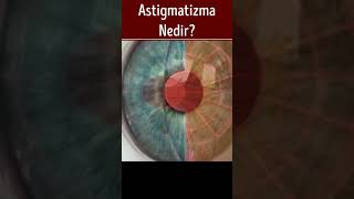 Astigmatizma ve Astigmat Nedir [upl. by Aznecniv]