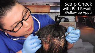 ASMR Scalp Check with Bad Results Dry Skin Removal Dandruff Removal Scalp Treatment Medical RP [upl. by Adnawaj]