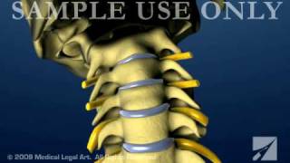 Cervical Spine and Intervertebral Disc Anatomy  Female Version [upl. by Iroak]