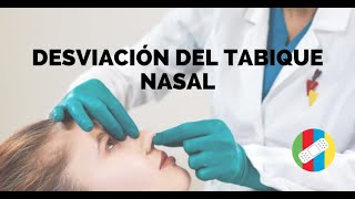 DESVIACIÓN DEL TABIQUE NASAL [upl. by Bobbie]