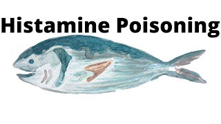 Histamine Poisoning [upl. by Gleich714]