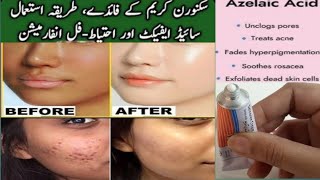 skinoren cream use and side effects  How to use azelaic acid [upl. by Orlosky]