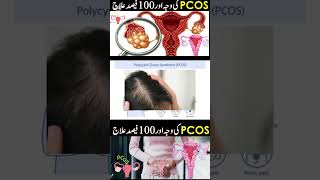 Why Did I Get PCOS Polycystic Ovarian Syndrome in UrduHindi [upl. by Ahsini902]