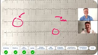 EKG befunden Echtes EKGFallbeispiel mit ärztlicher Auswertung  Kommst du auf die Diagnose [upl. by Leamhsi]