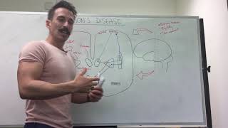 Parkinsons disease  Dopamine and the basal ganglia [upl. by Negem]