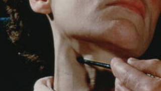 Jugular venous pulse 1957 Pt 3 of 4 [upl. by Grote]