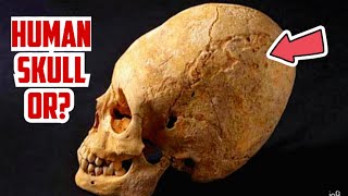 DNA Tests Reveal 3000yearold Paracas Skulls Are Of Unknown Human Race [upl. by Aninad]