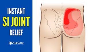 How to Relieve Sacroiliac Joint Pain in 30 SECONDS [upl. by Einnel]