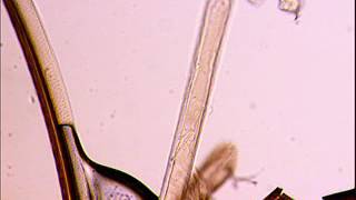 ​Trypanosoma congolense in the tsetse proboscis [upl. by Kort102]