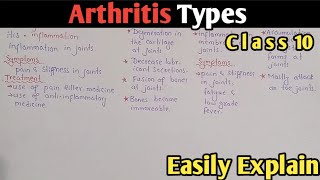 Arthritis  Osteoarthritis  Rheumatoid  Gout  Class 10 Biology UrduHindi [upl. by Bunni]