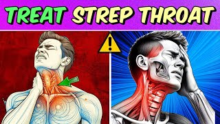 How to treat strep throat infection Home remedies for strep throat [upl. by Ecirtnuahs]