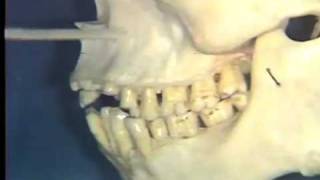 Gross Anatomy Nerve Supply to Teeth Maxillary Sinus [upl. by Notsgnal]