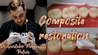 Composite restoration Composite modeling of tooth anatomy Dr Gustavo Passarelli Petris [upl. by Lette]