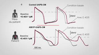 Fil rouge  Identifier des anomalies cellulaires en relation avec le syndrome du QT long [upl. by Niatsirhc]