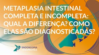 Metaplasia intestinal completa e incompleta qual a diferença Como elas são diagnosticadas [upl. by Dnomsed]