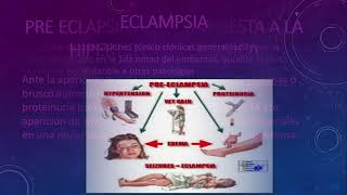 25 Sindromes Hipertensivos y embarazo [upl. by Carlos]