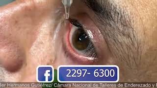 ENDORET PARA EL OJO SECO PTERIGIÓN Y CORNEA SALUD Y ALGO MÁS CANAL 11 Y 4 16 MARZO 2024 [upl. by Acnairb]