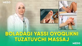 Boladagi yassi oyoqlikni tuzatuvchi massaj  MEDO [upl. by Irrep]