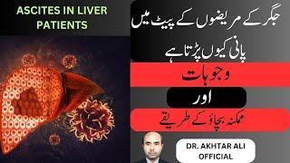 Ascites in liver patients  jigar k mareez k pait main pani kion parta hai  dr akhtar ali official [upl. by Flann715]