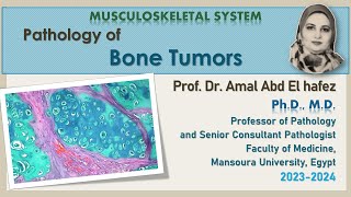 Bone tumors lecture أورام العظام شرح محاضرة [upl. by Raney]