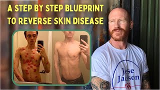 Revealing the complete step by step BLUEPRINT for permanent eczema psoriasis dermatitis reversal [upl. by Conner]