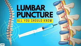 Lumbar Puncture Everything You Need to Know [upl. by Percy]