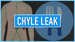 Chyle Leak  Emphasis on DietNutrition [upl. by Dominic]