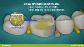 everStick XENIUS base instructions for use [upl. by Ardnasxela]