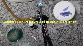 Oxidase Test Positive Procedure Result and Interpretation [upl. by Tammi]