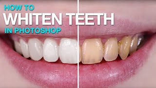 How to Whiten Teeth in Photoshop [upl. by Schaaff]