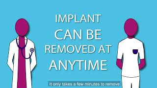 NHS Contraceptive Implant Information Video [upl. by Ibok288]