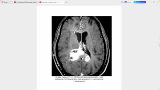 OSBORNE BRAIN IMAGING [upl. by Leamiba694]