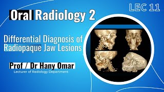 Oral Radiology 2  Lec 11  Differential Diagnosis of Radiopaque Jaw Lesions [upl. by Sivle]