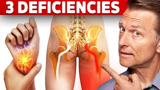 The 3 Vitamin Deficiencies in Sciatica and Carpal Tunnel Syndrome [upl. by Danuloff358]